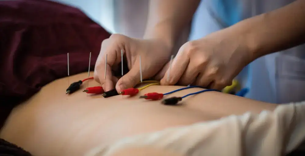 Acupuncture-high-blood-pressure-treatment