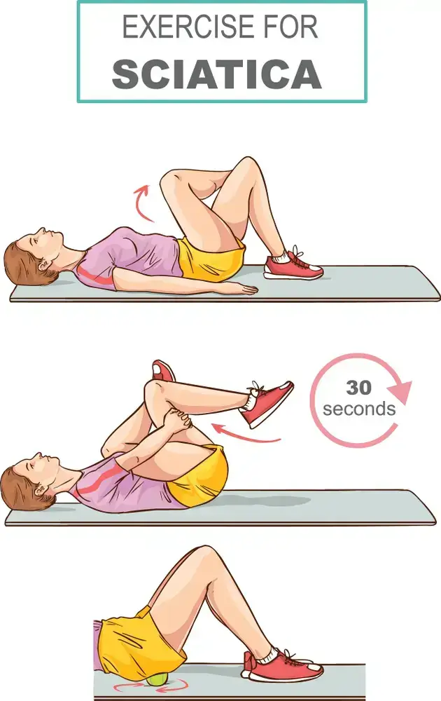 Exercise-for-Sciatica