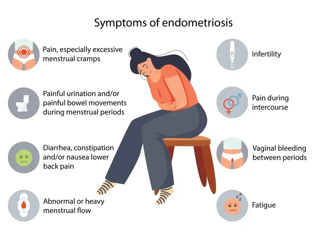 Endometriosis symptoms and signs