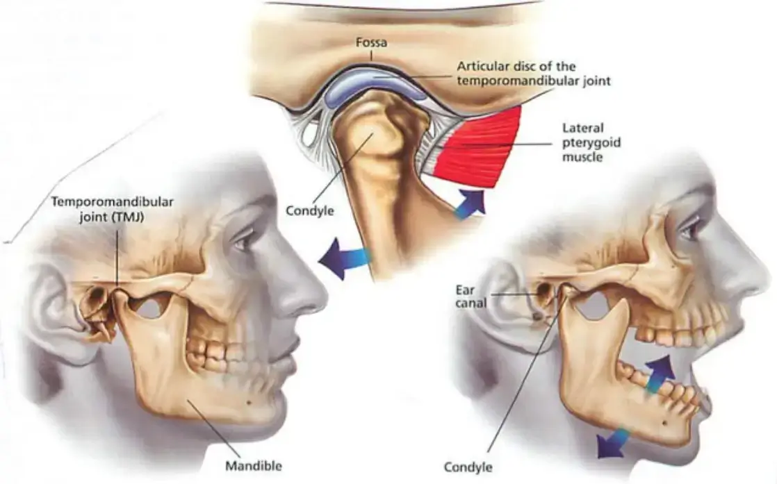 TMJ-Symptoms