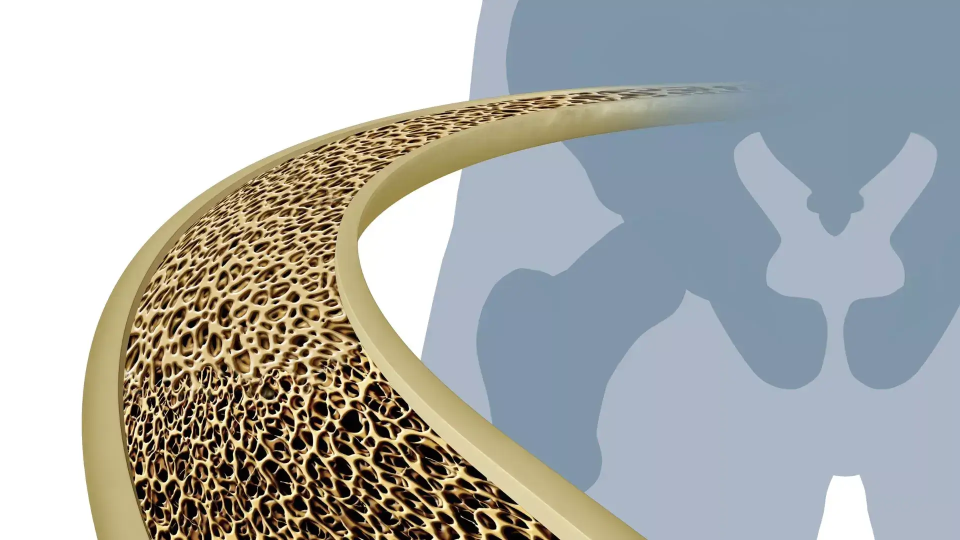 Osteoporosis Back Pain