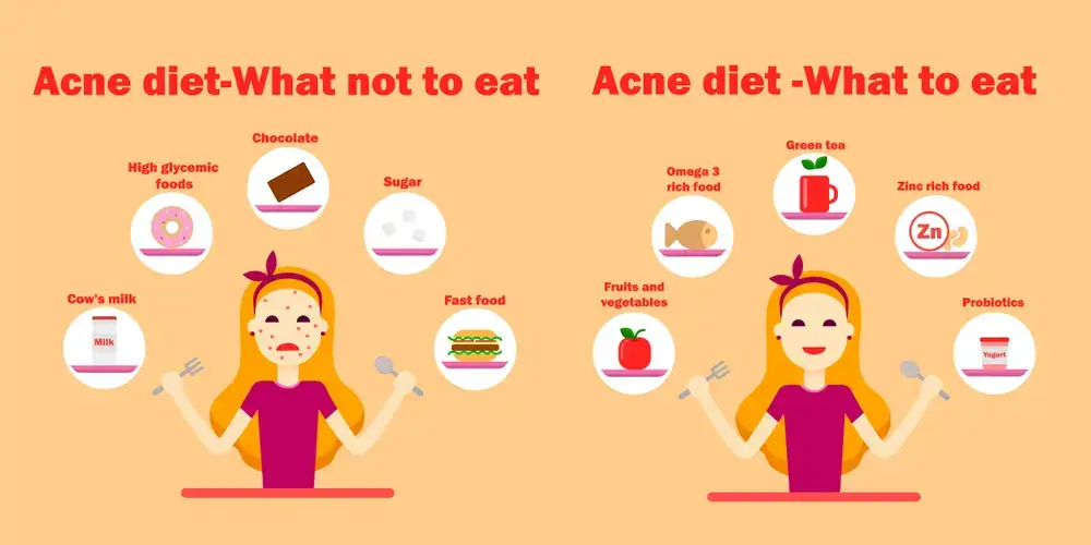What-foods-cause-Acne