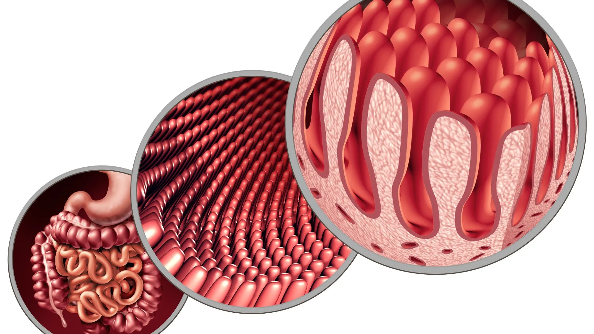 Intestinal-Permeability