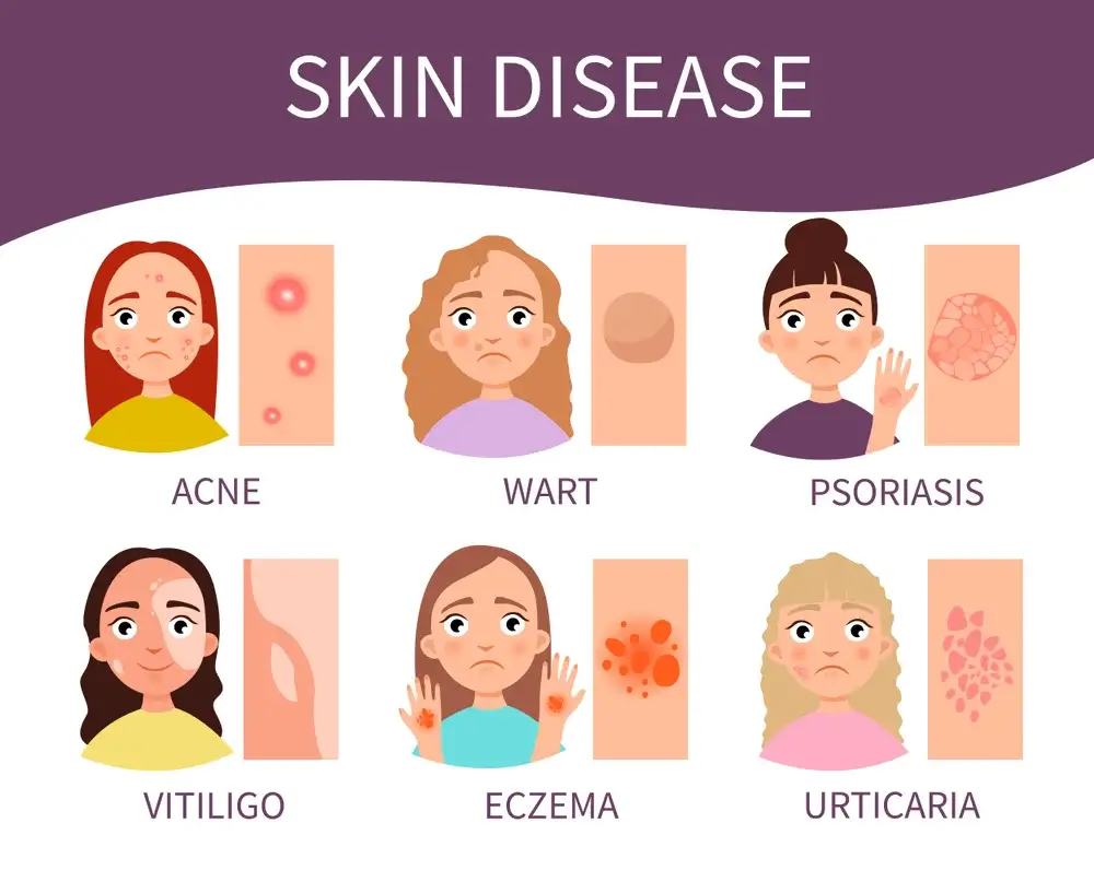 Acne Treatment Clinic