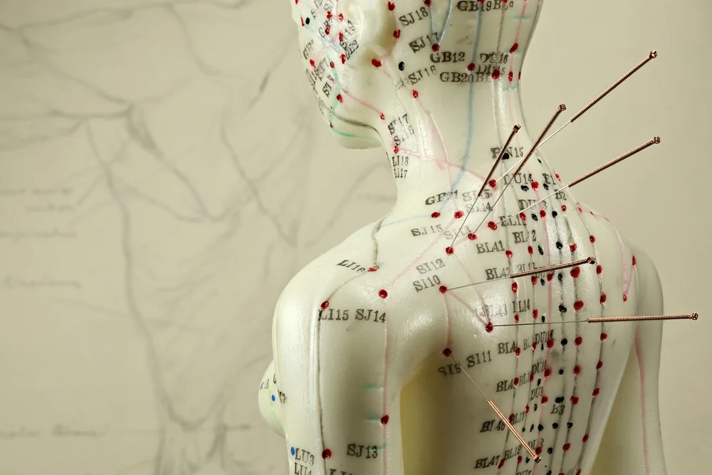 Best Acupuncture Clinic in Mississauga