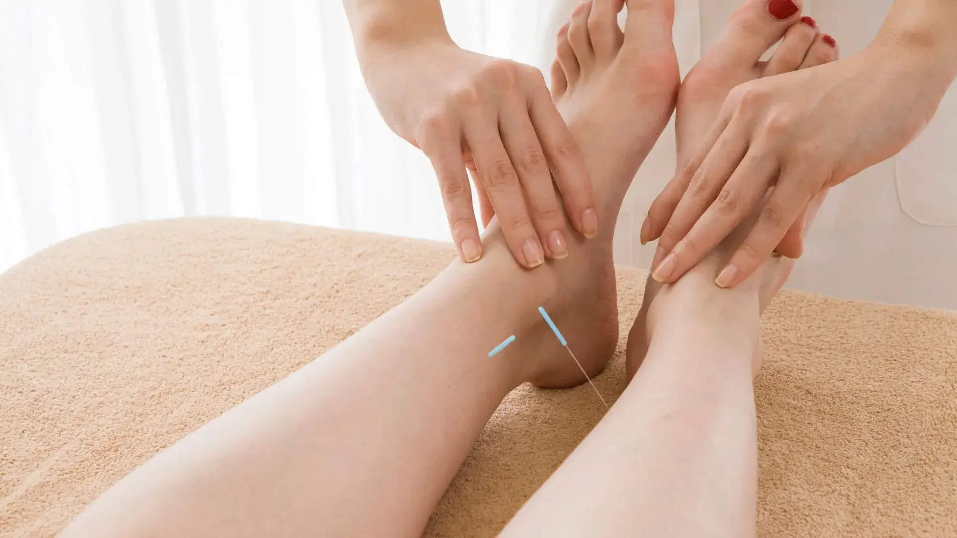 Acupuncture Lower Leg