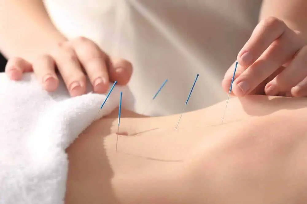 Acupuncture-for-Infertility