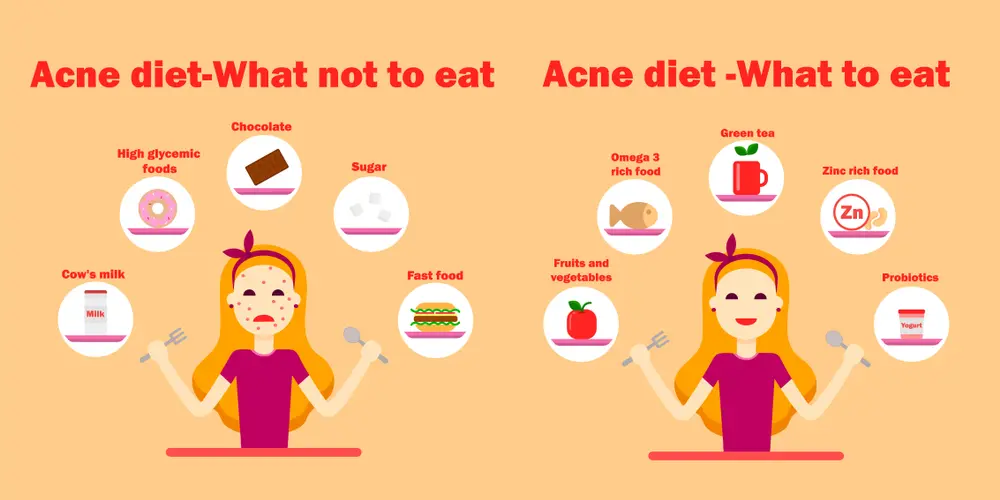 What-foods-cause-Acne