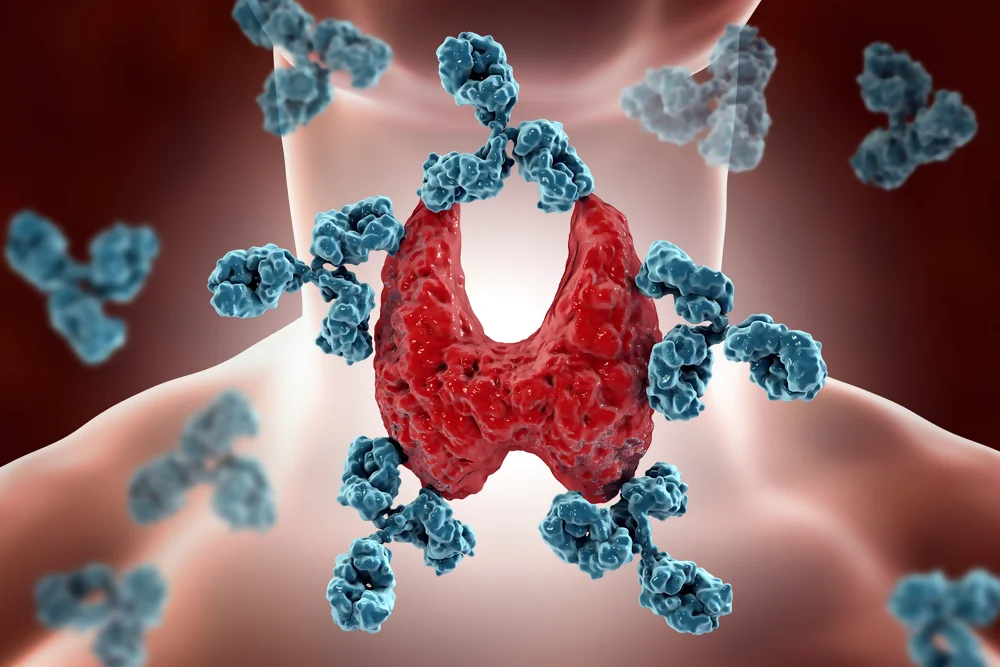 Autoimmune disorders - Thyroid Issues
