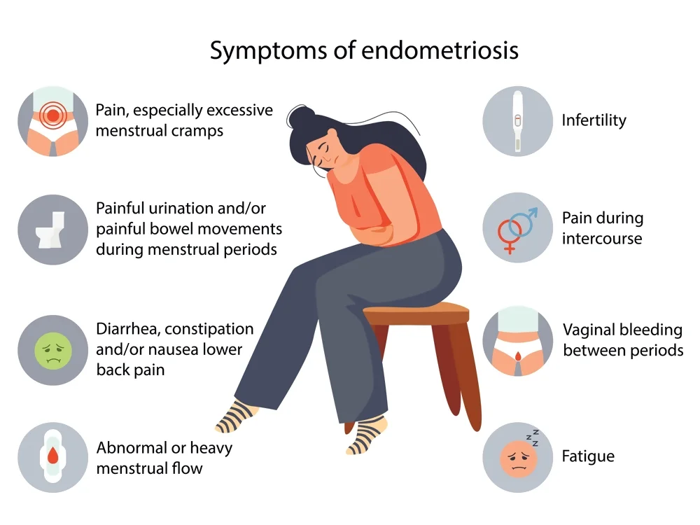 Endometriosis symptoms and signs