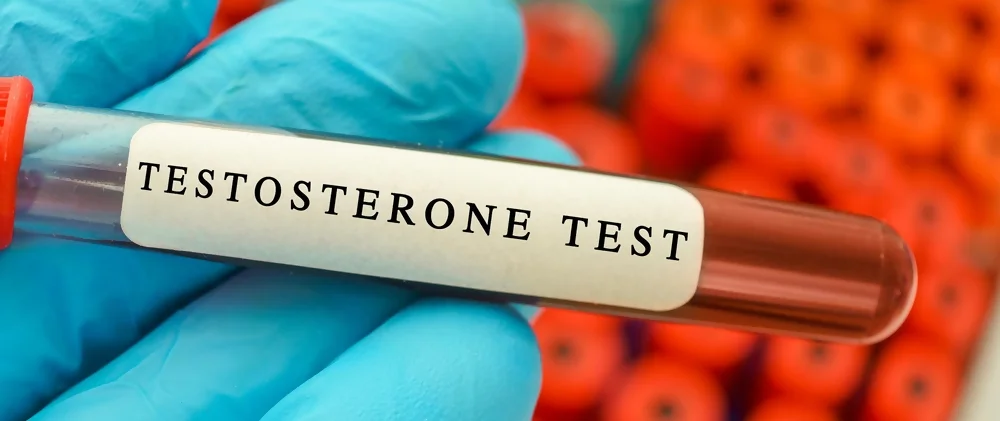 menopause in men testosterone test