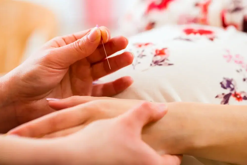 Acupuncture-Pregnancy