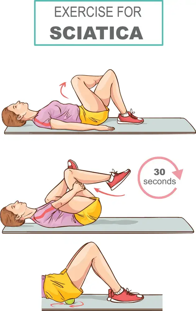 Exercise-for-Sciatica