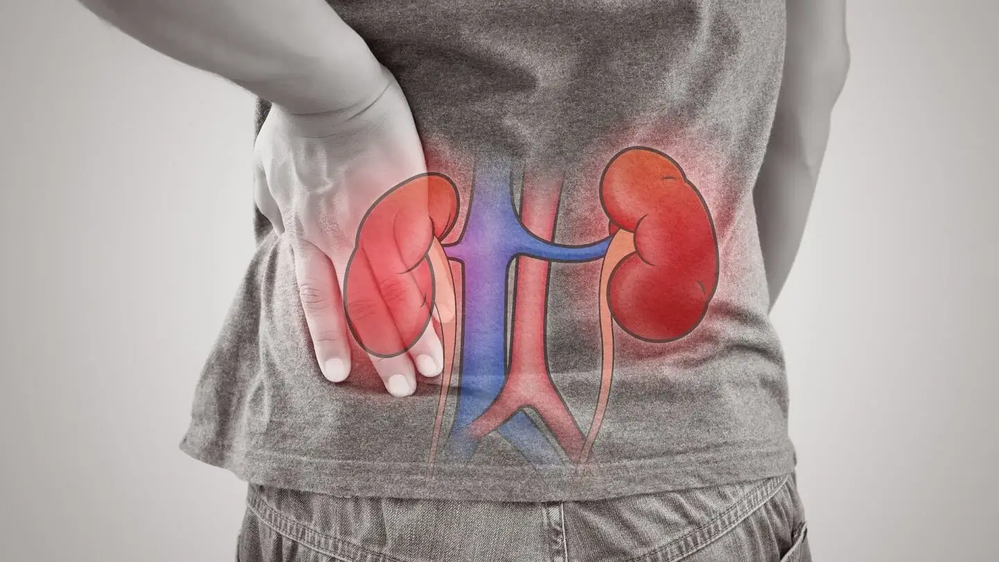 Glomerulonephritis