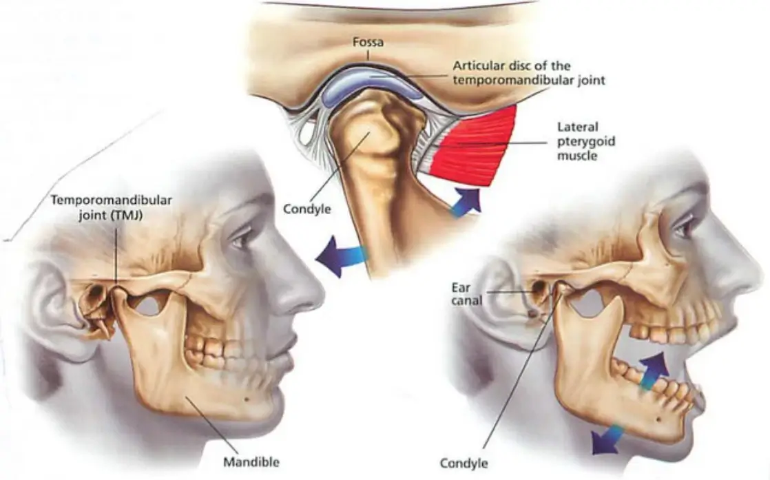 TMJ-Symptoms