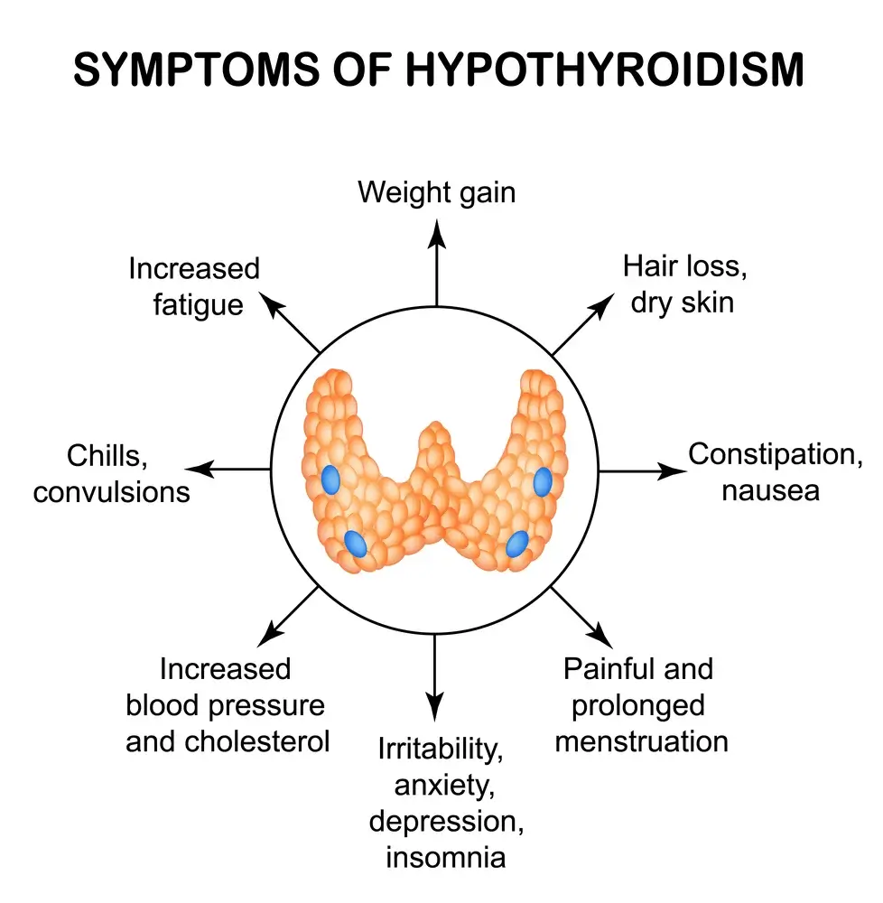 Thyroid-issues-Hypothyroidism Waterdown Acne Clinic Treatment